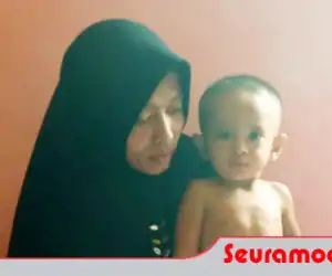 Bocah Tanpa Anus Di Aceh Barat Butuh Bantuan Donatur