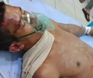 Pria Amukan Massa di Nagan Raya, Diduga Alami Gangguan Jiwa