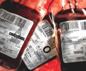 Berikut Hasil Studi Golongan Darah Lebih Rentan Terinfeksi COVID-19