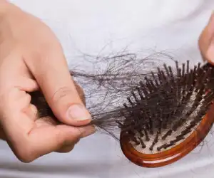 Berikut Cara Mengatasi Rambut Rontok dengan Bahan Alami
