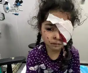 Miris! Akibat Genosida Israel, 1.500 Warga Gaza Mengalami Kebutaan