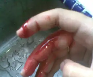 Waduh..! Kecewa Salah Pilih Partai, Jari Sendiri di Potong
