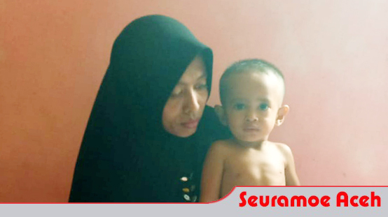 Bocah Tanpa Anus Di Aceh Barat Butuh Bantuan Donatur